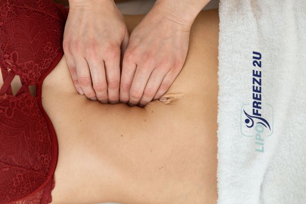 diastasis recti treatment Minehead