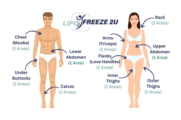 Areas you can have fat freezing treatment Minehead
