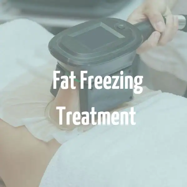 fat freezing treatment Minehead