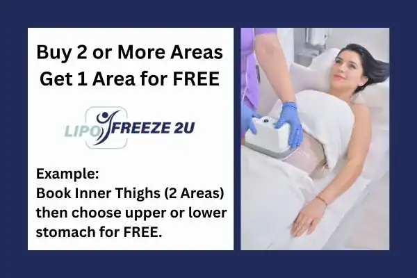fat freezing prices Minehead