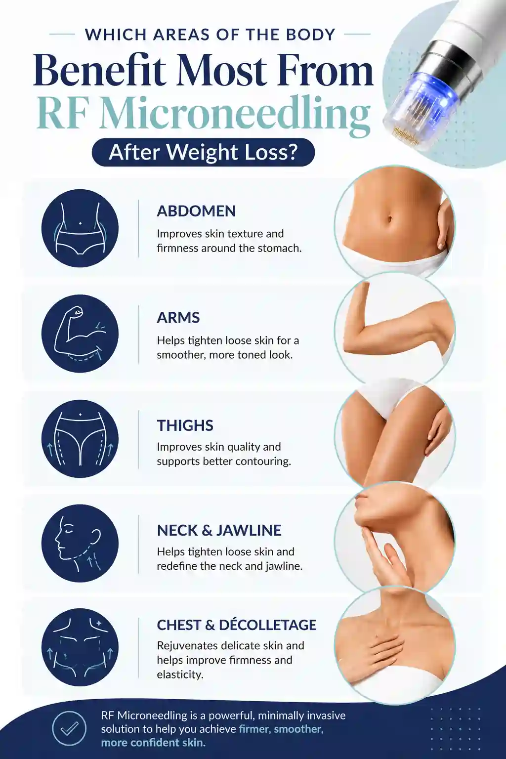 Which Areas of the Body Benefit Most From RF Microneedling After Weight Loss Minehead